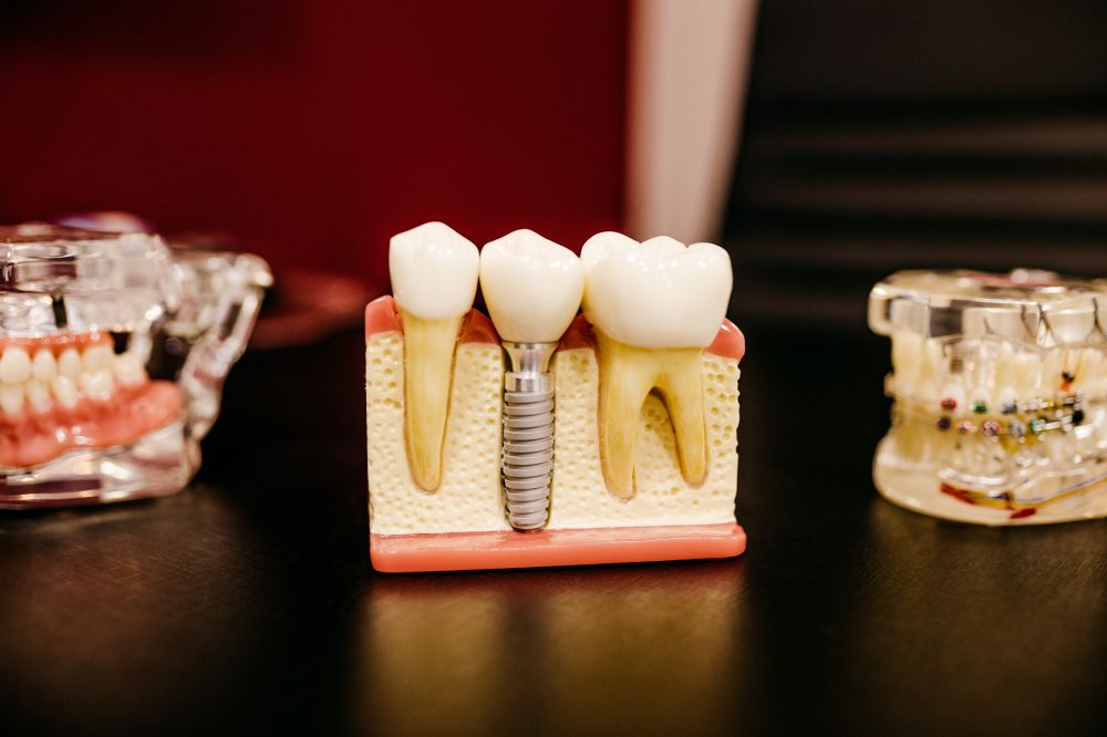 tandhygienist-p-odenplan-ser-till-att-du-f-r-b-sta-tandv-rden